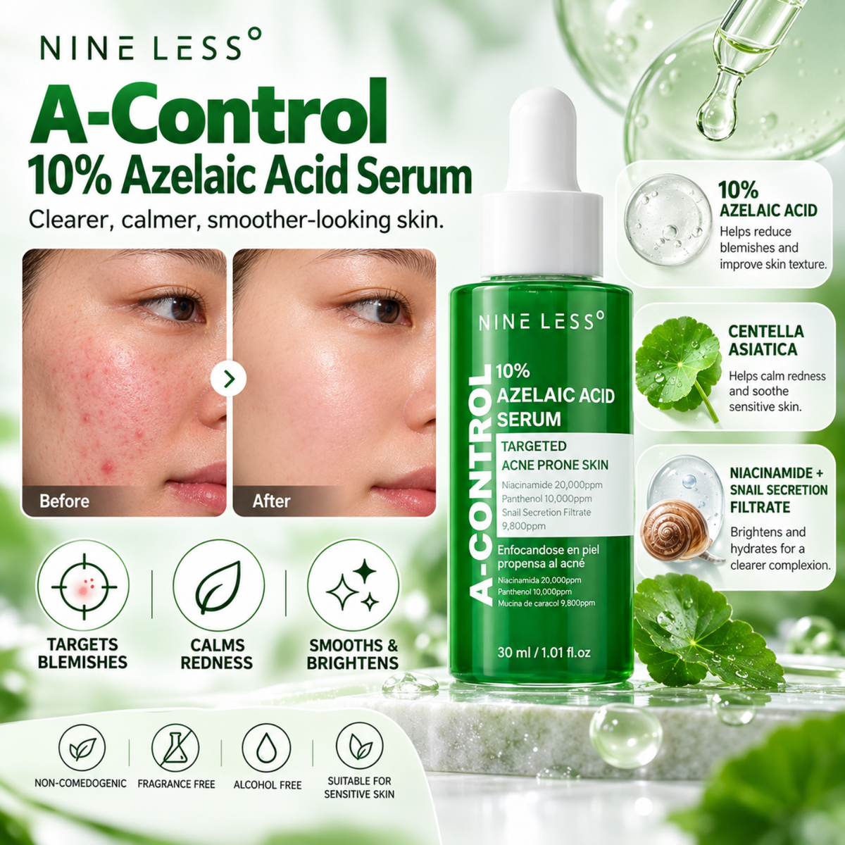 NINELESS A-Control 10% Azelaic Acid Serum 30ml