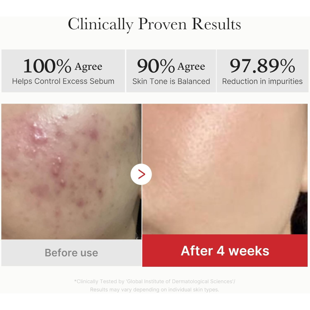 MEDICUBE Red Succinic Acid Peeling Pad 70ea