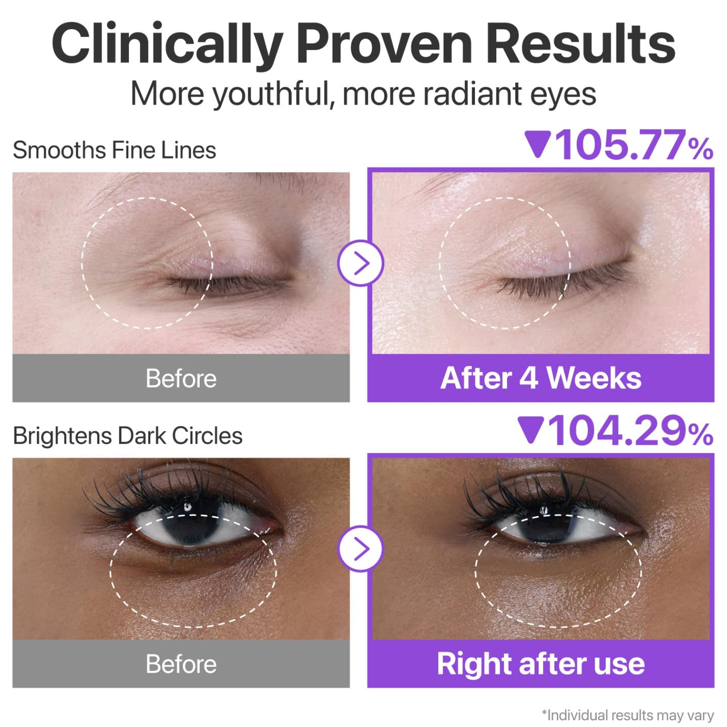 NUMBUZIN No.9 NAD+ Retinol Volumetox Eye Cream 10ml