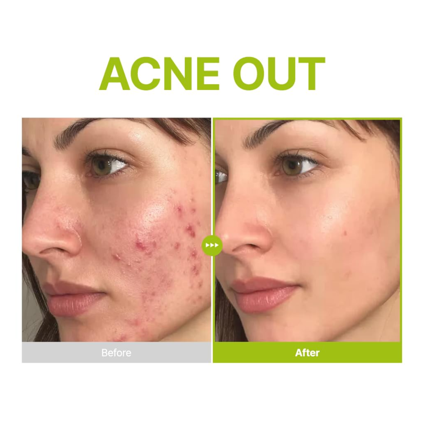 PURITO SEOUL Azelaic Acid 10 Kojic Tea Tree Serum 30ml