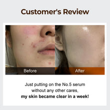 Load image into Gallery viewer, NUMBUZIN No.5 Goodbye Blemish Serum 50ml